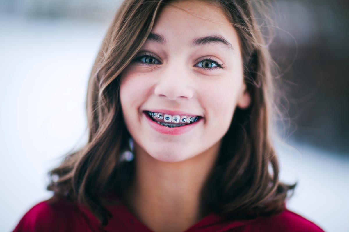 Braces 10 at Khan Dental Studio