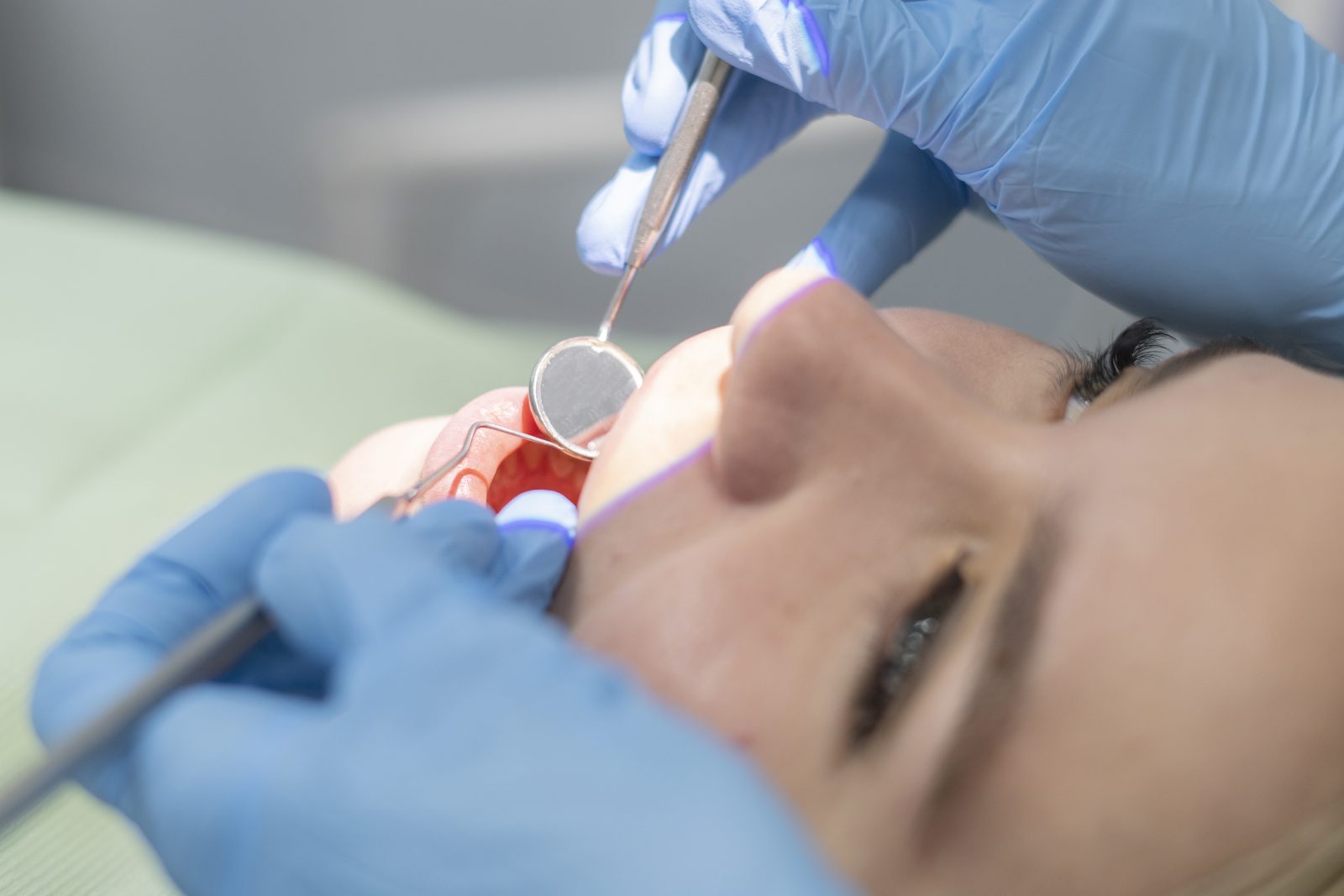 Restorative Dentistry: A Plain-English Guide