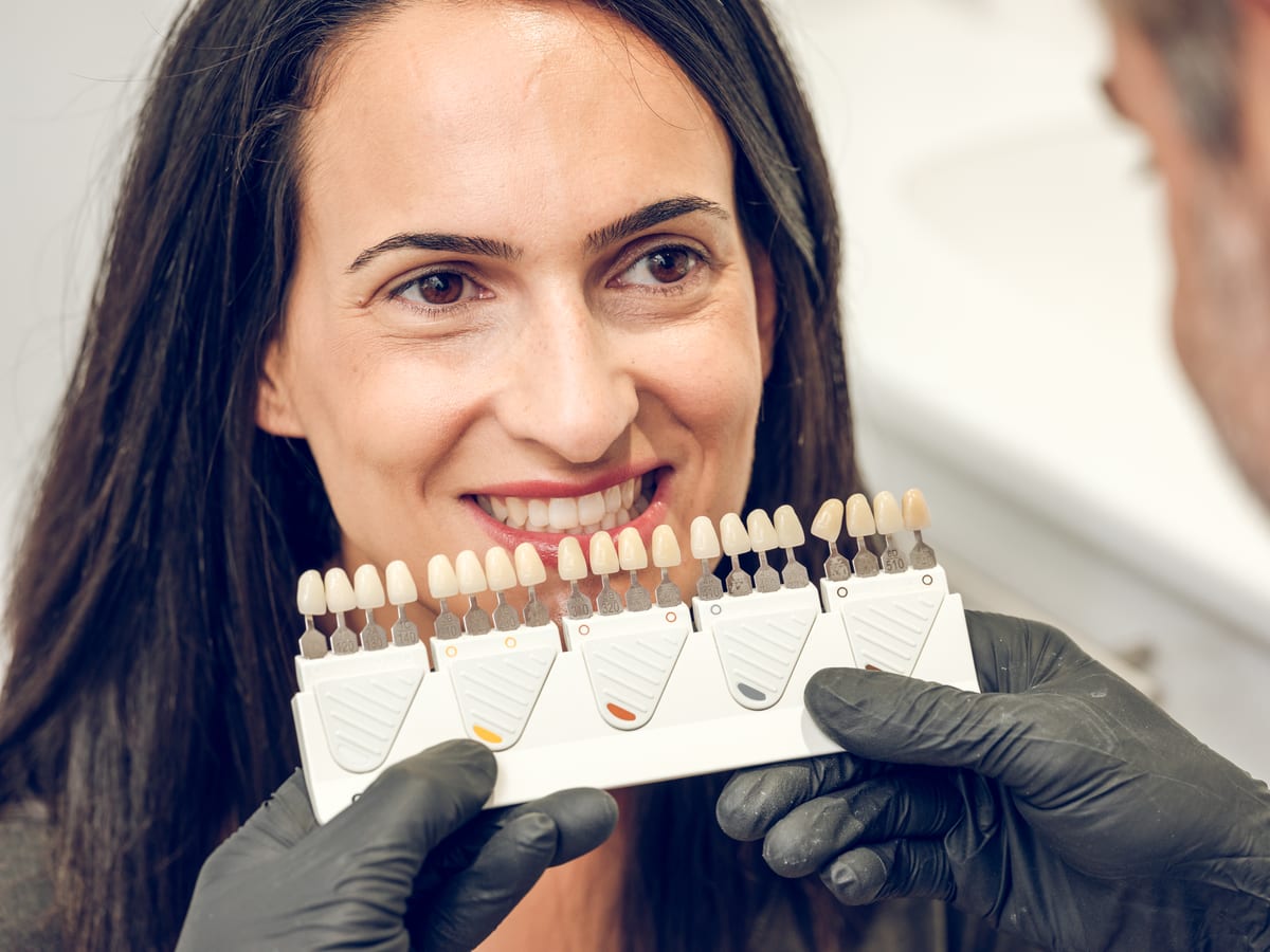Veneers 10 at Khan Dental Studio