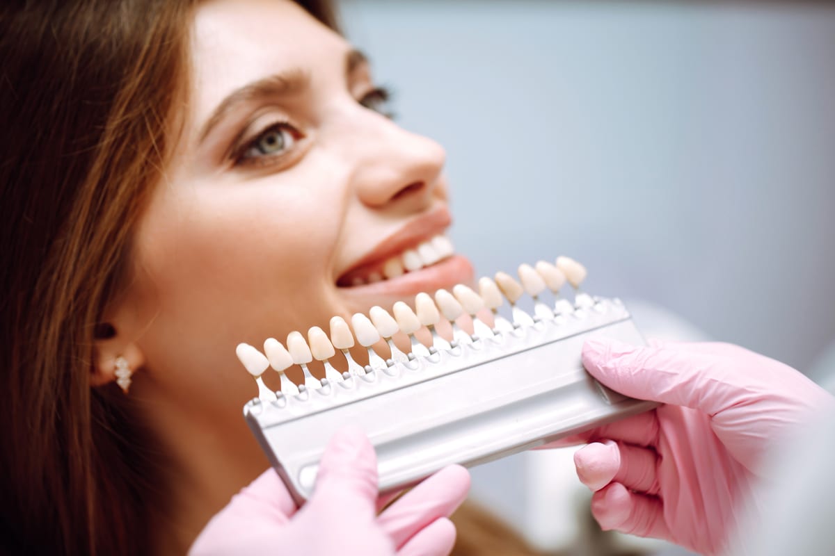 Veneers 11 at Khan Dental Studio