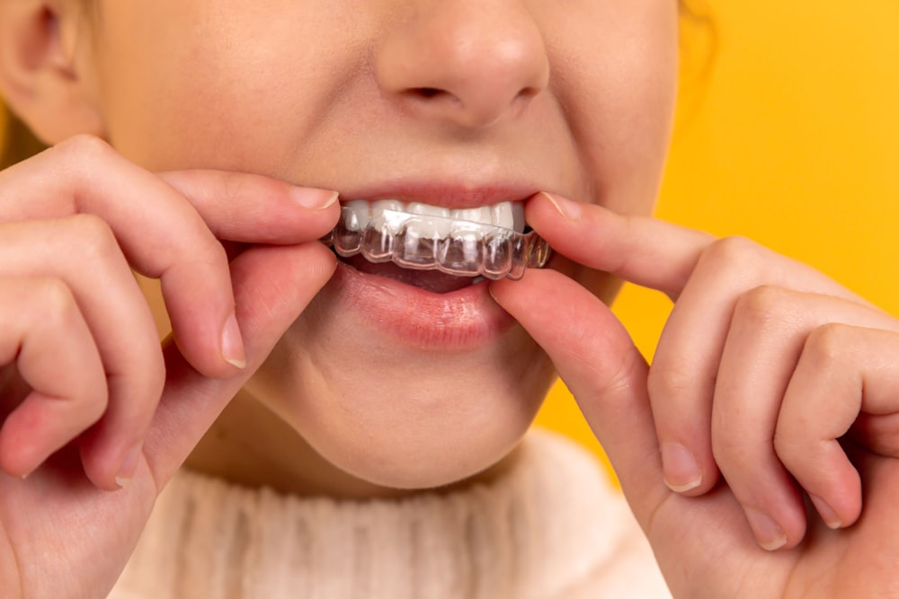 Invisalign & Braces