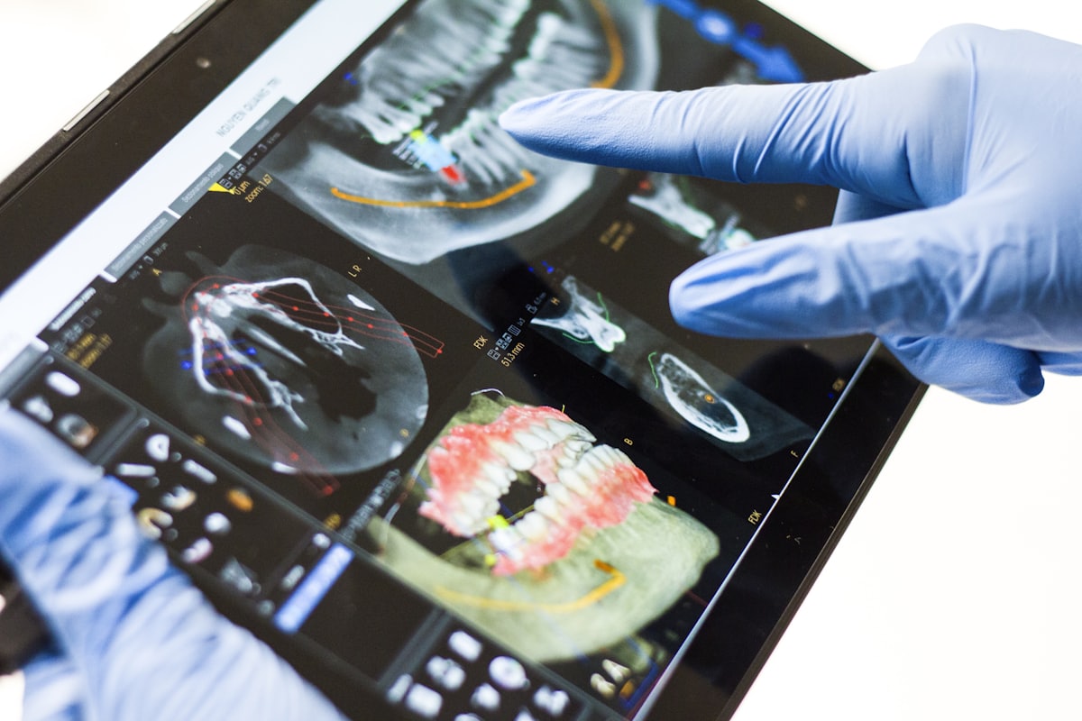 Digital 3D scanning at Khan Dental Studio